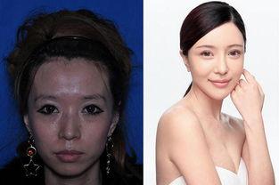 整形过后,整形术后蜕变之旅